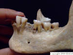 L_V20d5085 A16.31 R827 lR ta dental cavity on root surface.JPG L_V20d5085 A16.31 R827 lR ta dental cavity on root surface